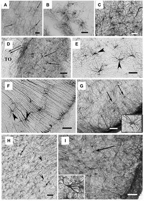 Evolution of astrocytes: From invertebrates to vertebrates